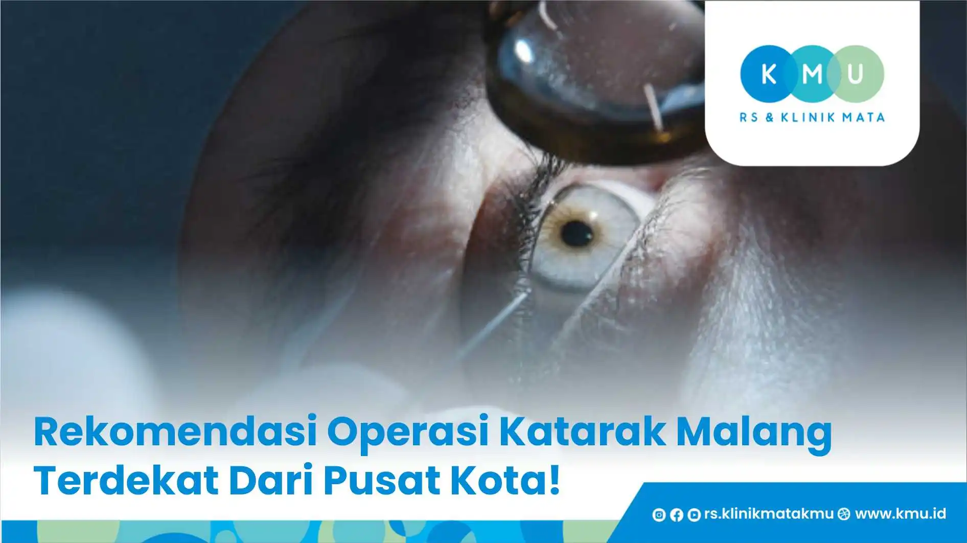Rekomendasi Operasi Katarak Malang Terdekat Dari Pusat Kota!